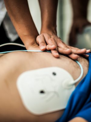 elettrodo per defibrillazione